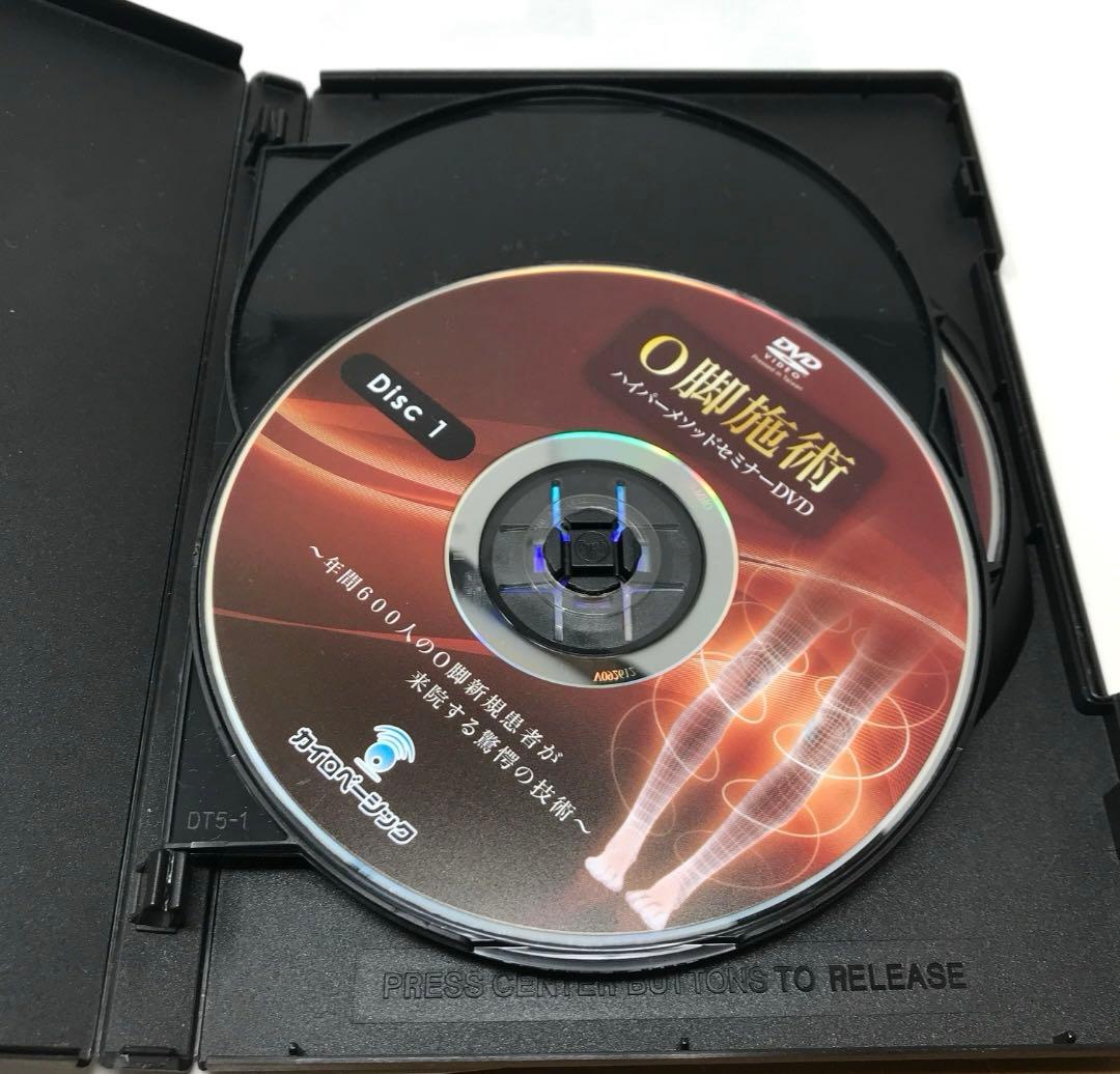 O脚施術ハイパーメソッドセミナーDVD 臨床動画DVD セット　テキスト付き