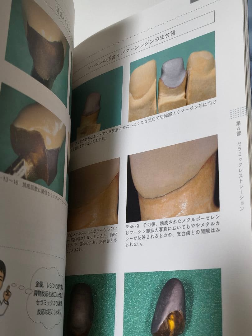 新装版 技工に強くなる本 上下巻セット 歯科技工 教科書 クインテッセンス