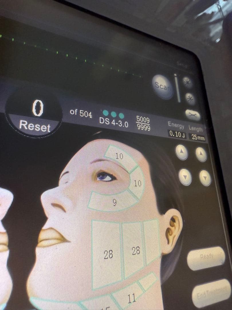 値下げ可能SMAS HIFU System 美顔器