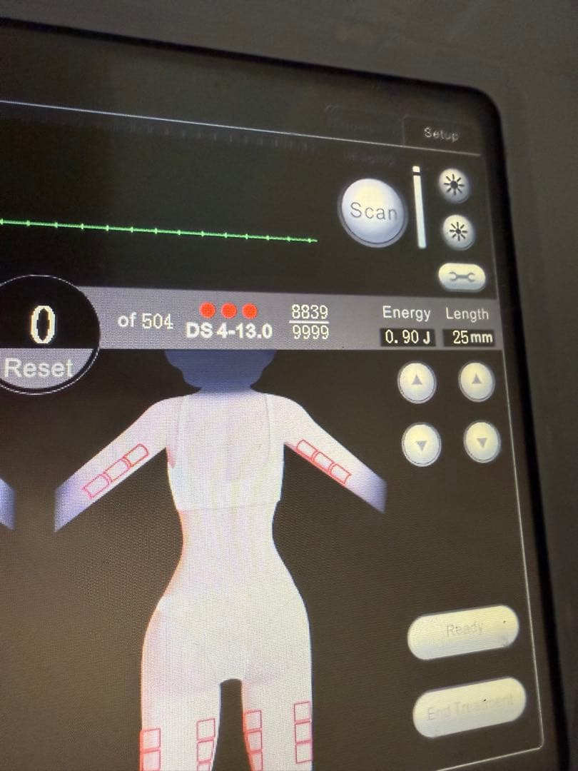 値下げ可能SMAS HIFU System 美顔器