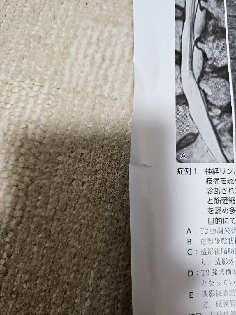 裁断済　三輪書店　エキスパートのための脊椎脊髄疾患のMRI 第3版