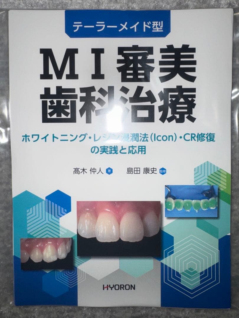 【裁断済み】テーラーメイド型　ＭＩ審美歯科治療