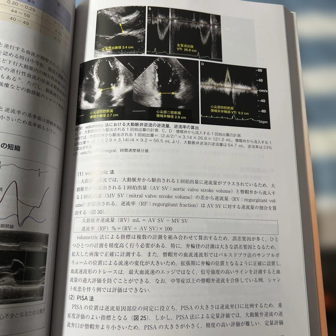 心臓超音波テキスト