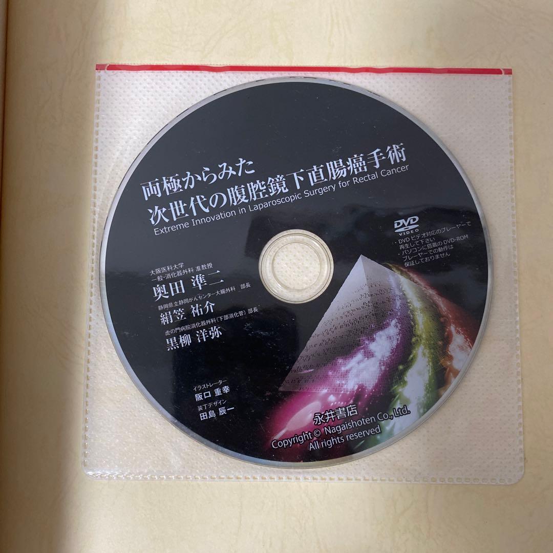 両極からみた次世代の腹腔鏡下直腸癌手術