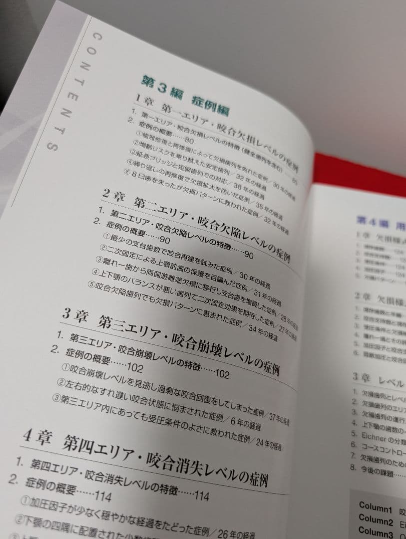症例でみる欠損歯列・欠損補綴 レベル・パターン・スピード 宮地 建夫 本 歯科
