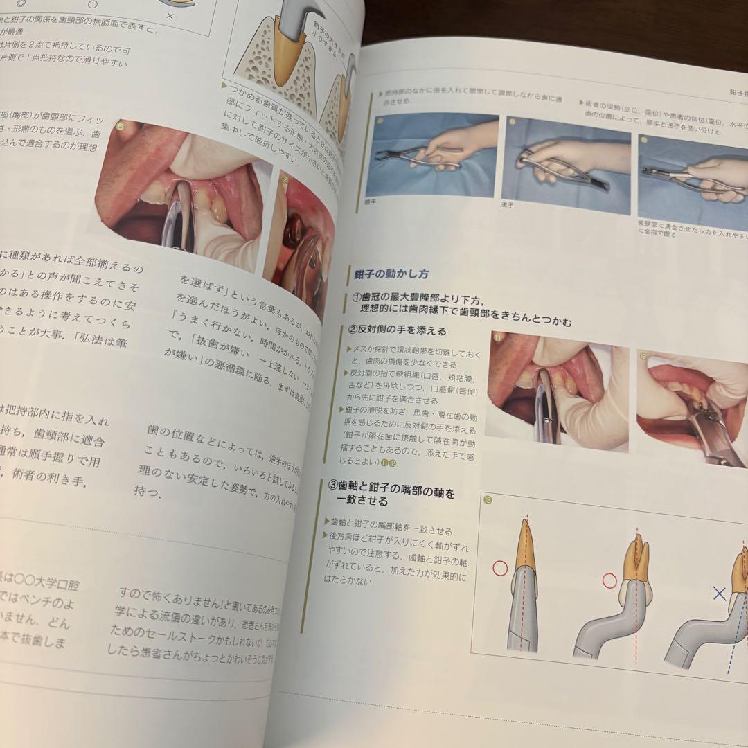 必ず上達　抜歯手技