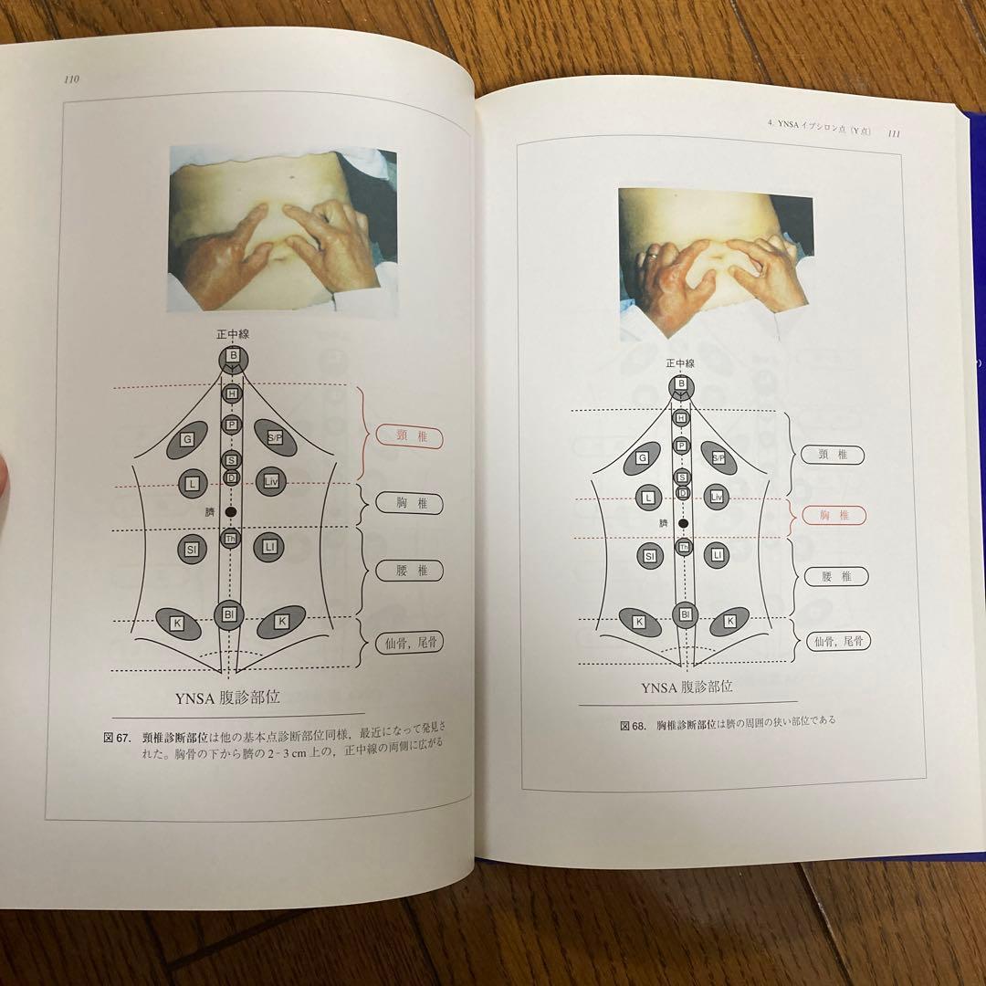 山元式新頭針療法YNSA