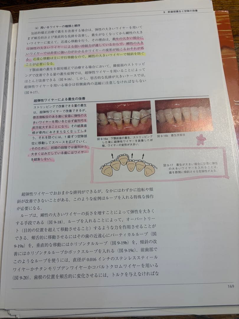 歯周矯正 GPがすべき五つの矯正治療