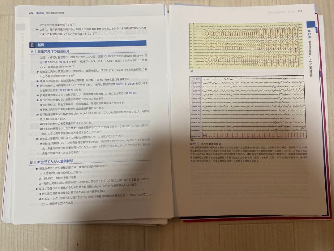 脳波で診る救急救命　意識障害を読み解くための脳波ガイドブック