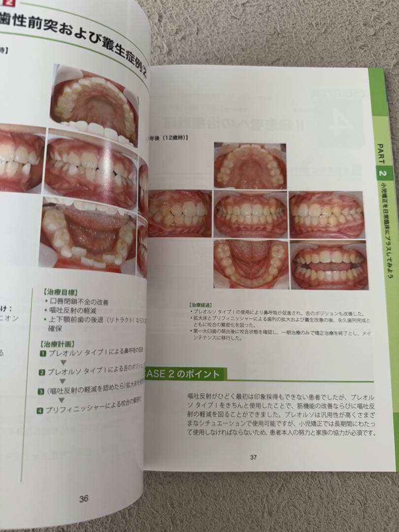 歯科　無理なくできるGP矯正治療導入マニュアル