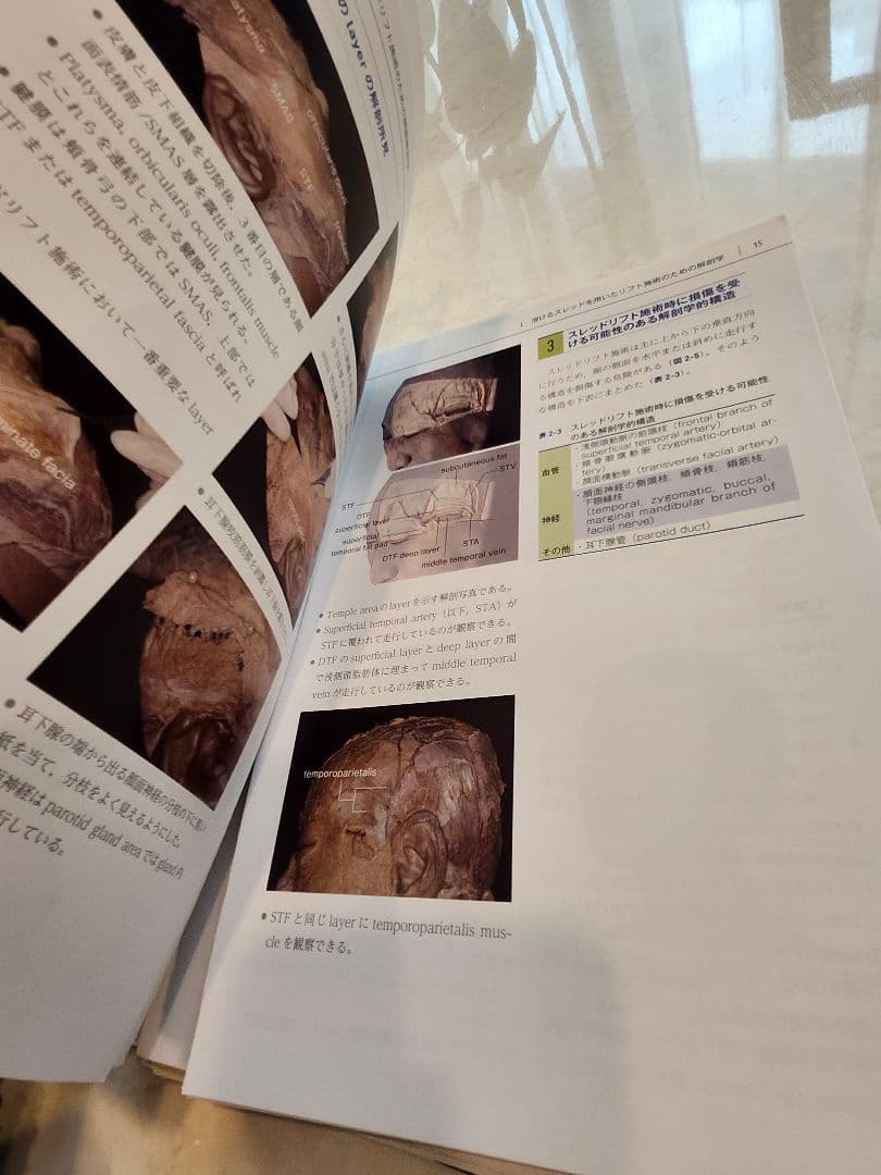 【裁断済】スレッドリフトのセオリー PINCH解剖学とテクニック