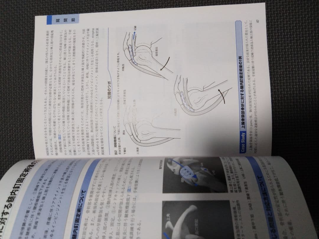 触診技術　整形外科ナビゲーション　上肢2冊セット　理学療法　新人　作業療法　PT