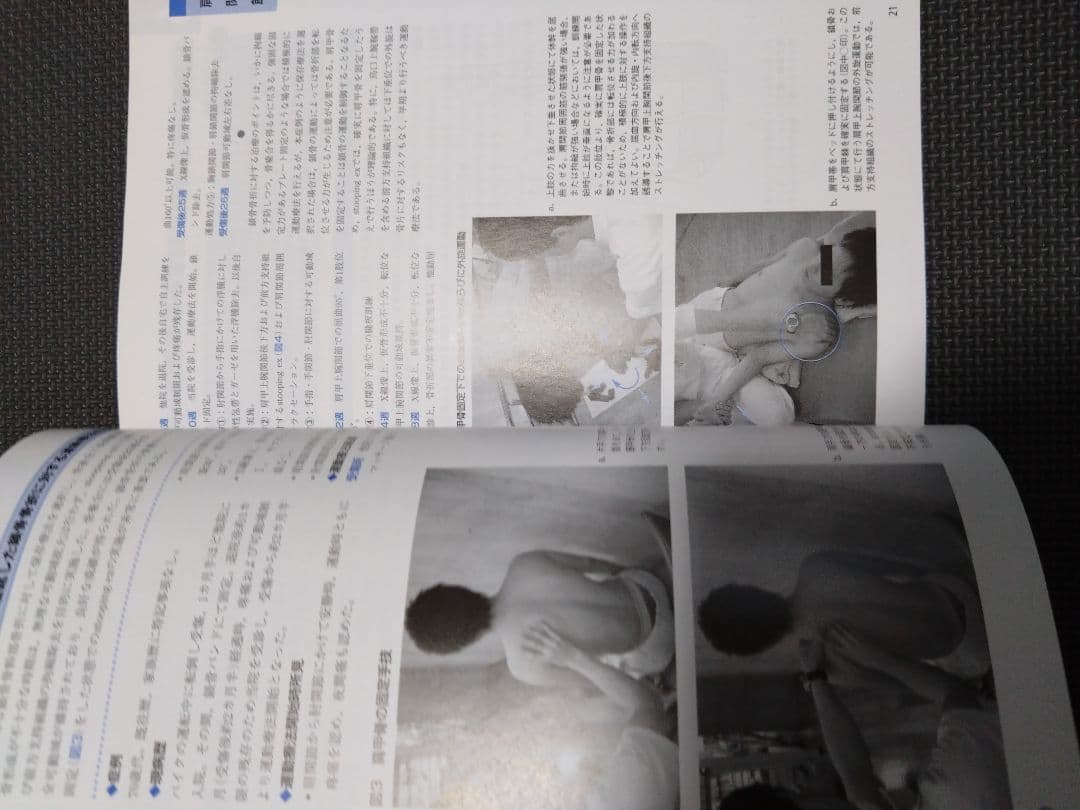 触診技術　整形外科ナビゲーション　上肢2冊セット　理学療法　新人　作業療法　PT