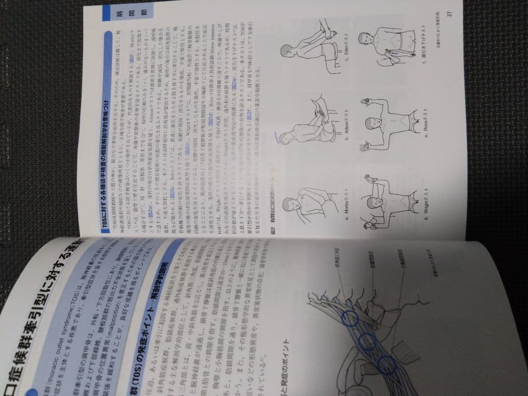 触診技術　整形外科ナビゲーション　上肢2冊セット　理学療法　新人　作業療法　PT