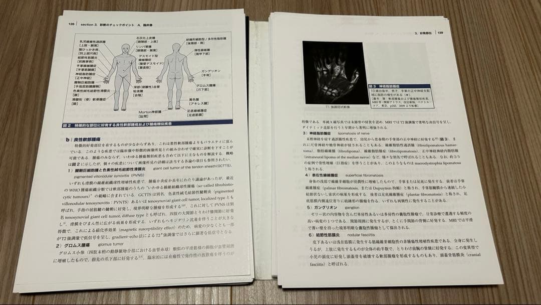 軟部腫瘍のMRI【裁断済み】