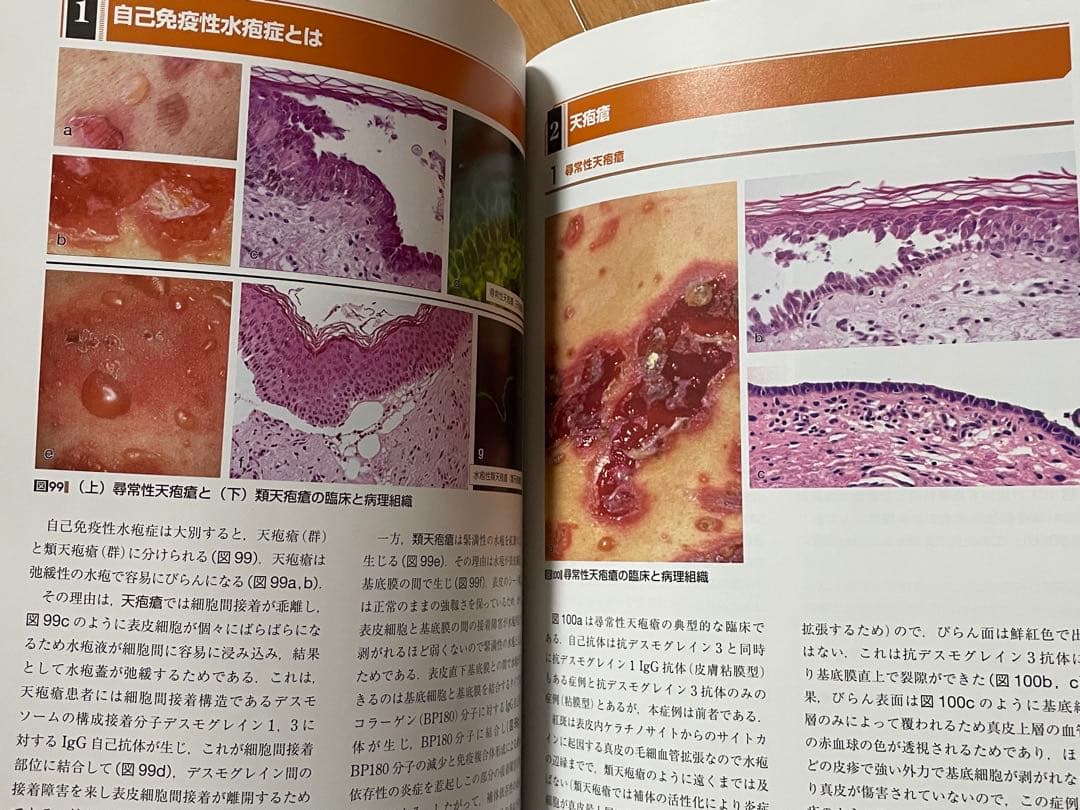 皮疹の因数分解・ロジック診断
