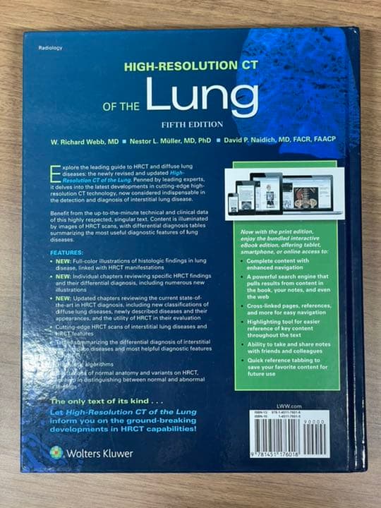 健康・医学 high-resolution CT of the lung