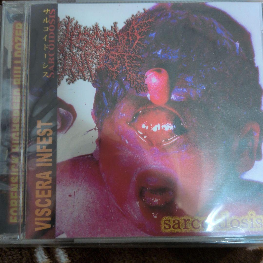 邦楽 VISCERA INFEST sarcoidosis