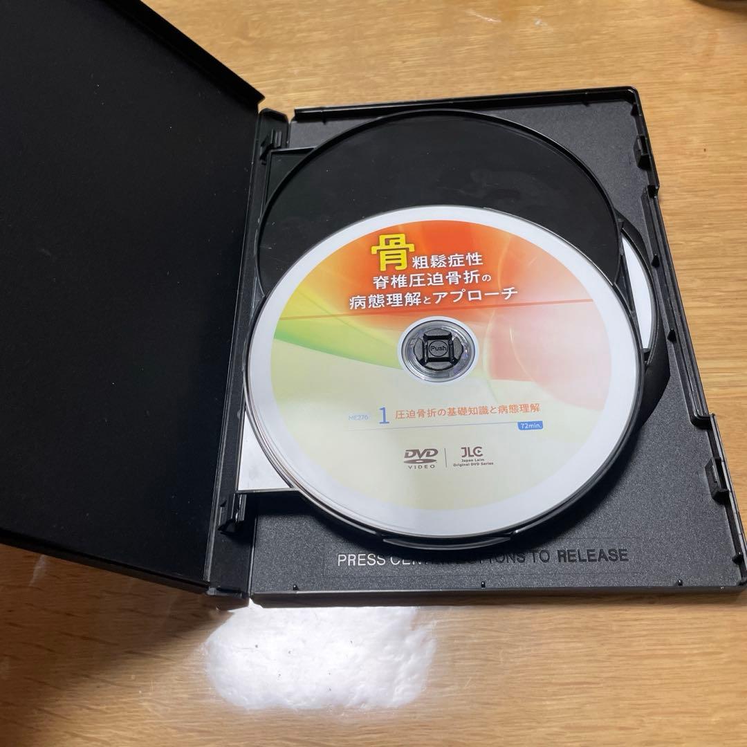 骨粗鬆症性脊椎圧迫骨折の病態理解とアプローチ　赤羽根良和