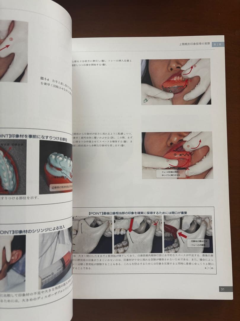 必ず上達 歯冠修復 上