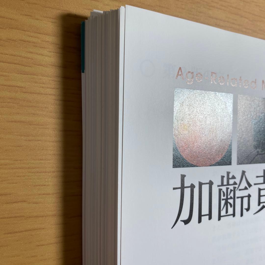 【裁断済】加齢黄斑変性 第2版