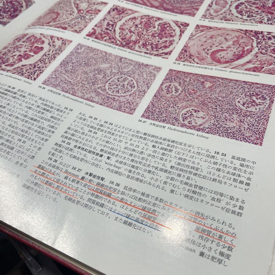 カラン 組織病理学アトラス 医学書院
