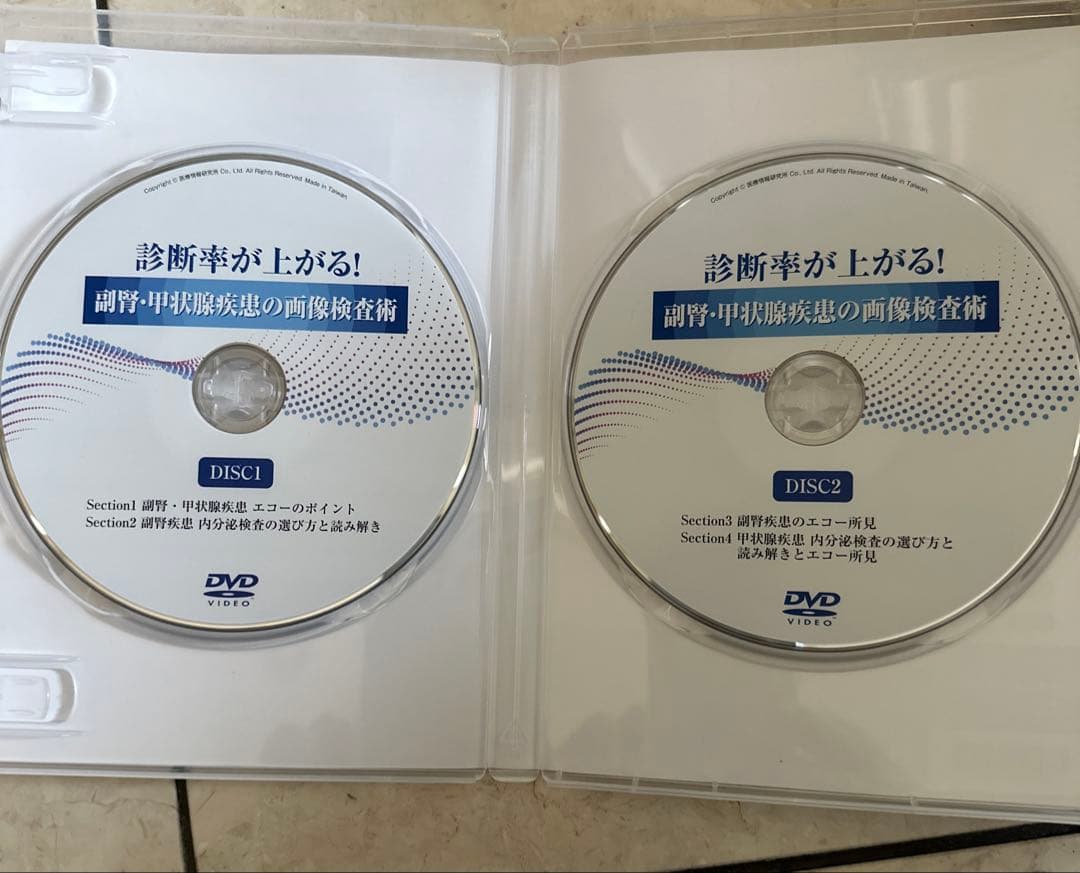 診断率が上がる! 副腎・甲状腺疾患の画像検査術