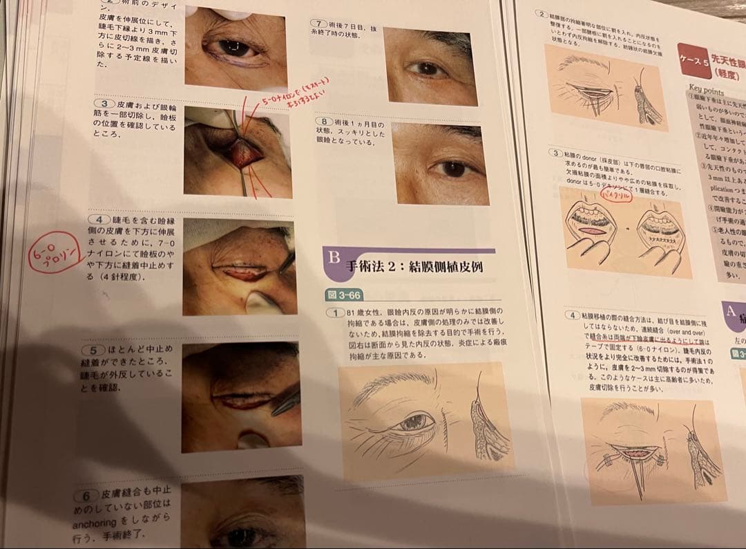スキル外来手術アトラス(裁断済み)