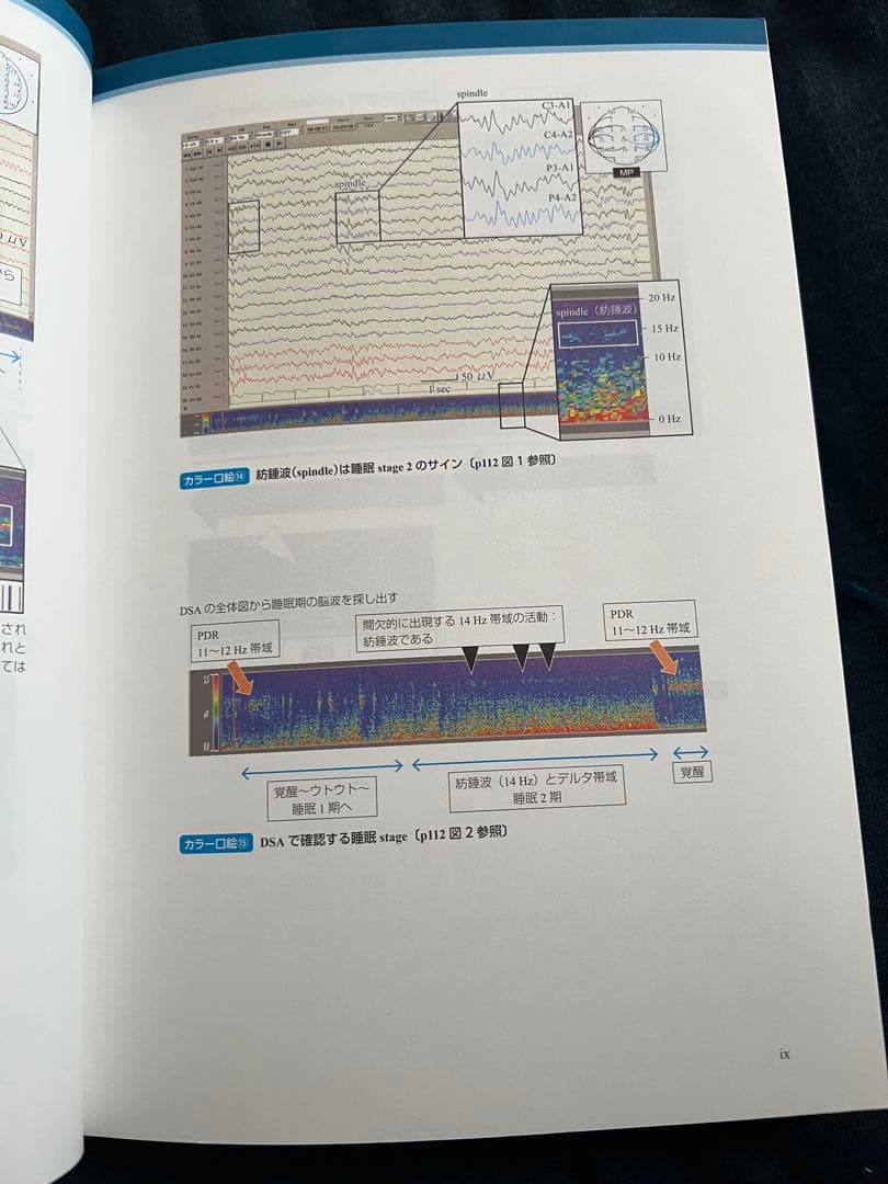 【良品】脳波判読 オープンキャンパス