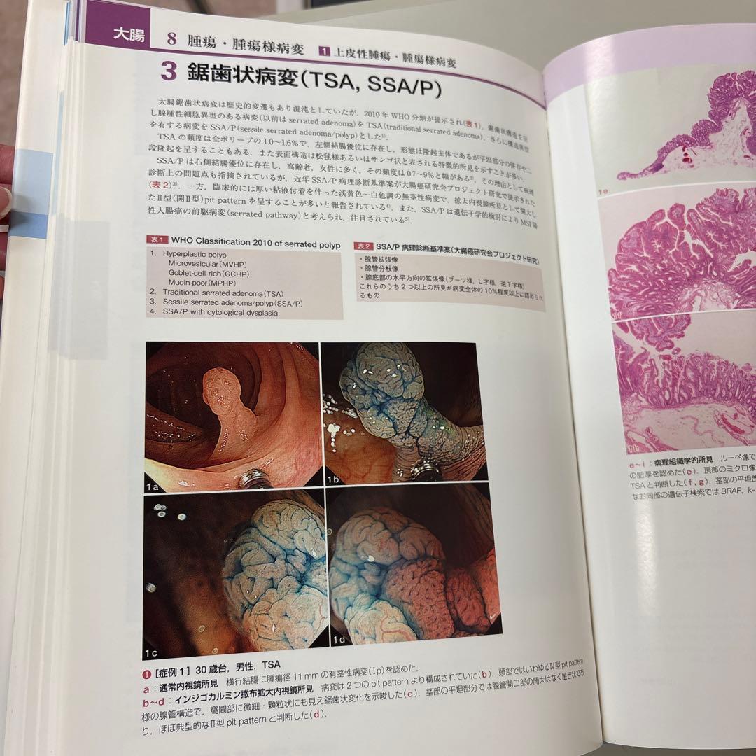 参考書　胃と腸アトラスⅠ 上部消化管、II 下部消化管 第2版