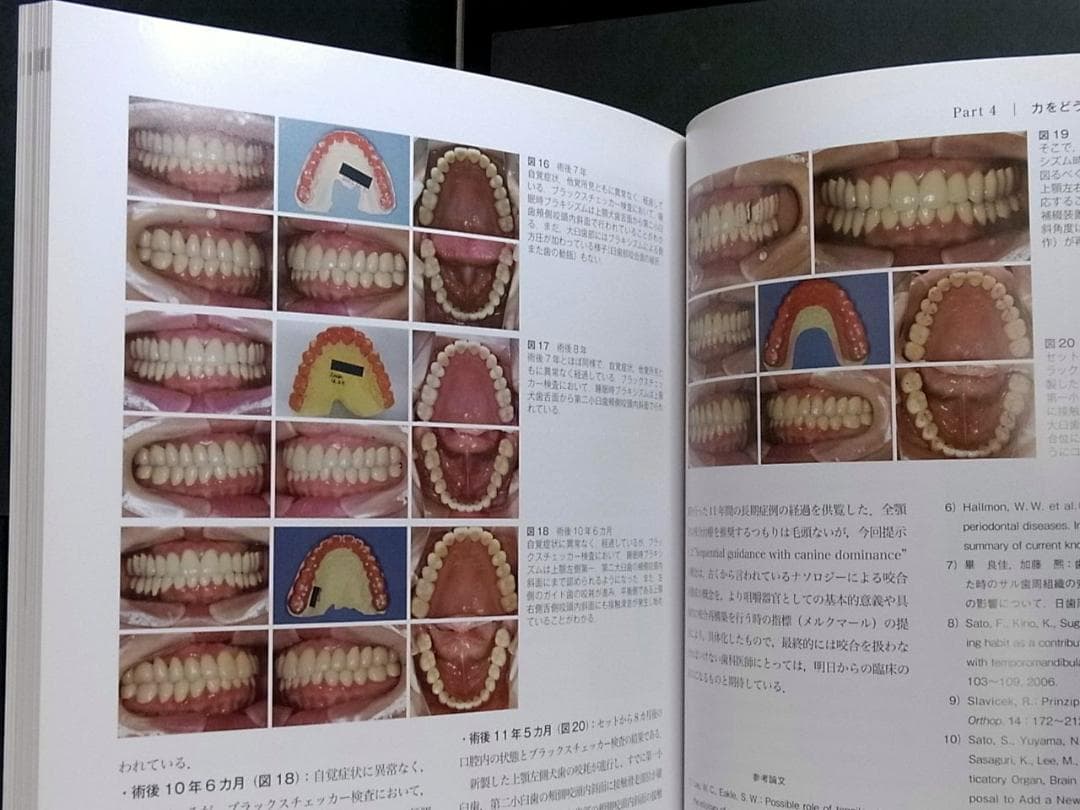 補綴臨床別冊 歯列を守る力のマネジメント 力を診る