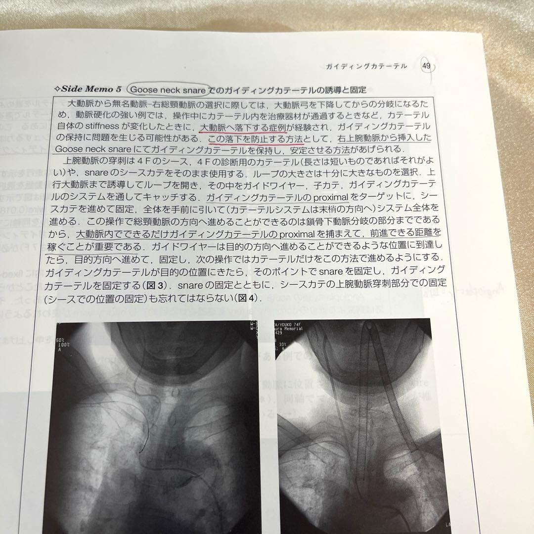 脳血管内治療のdo's & don'ts
