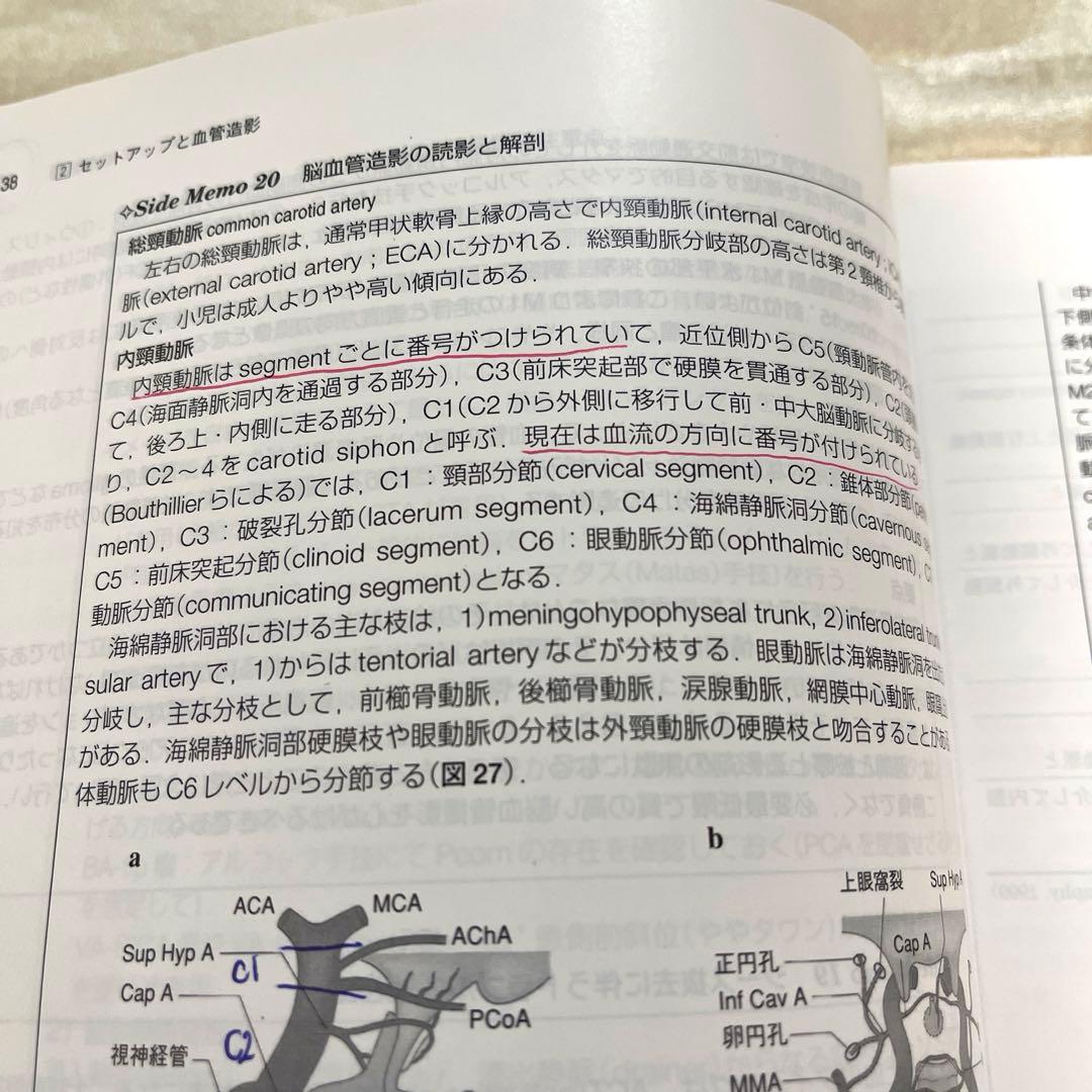 脳血管内治療のdo's & don'ts