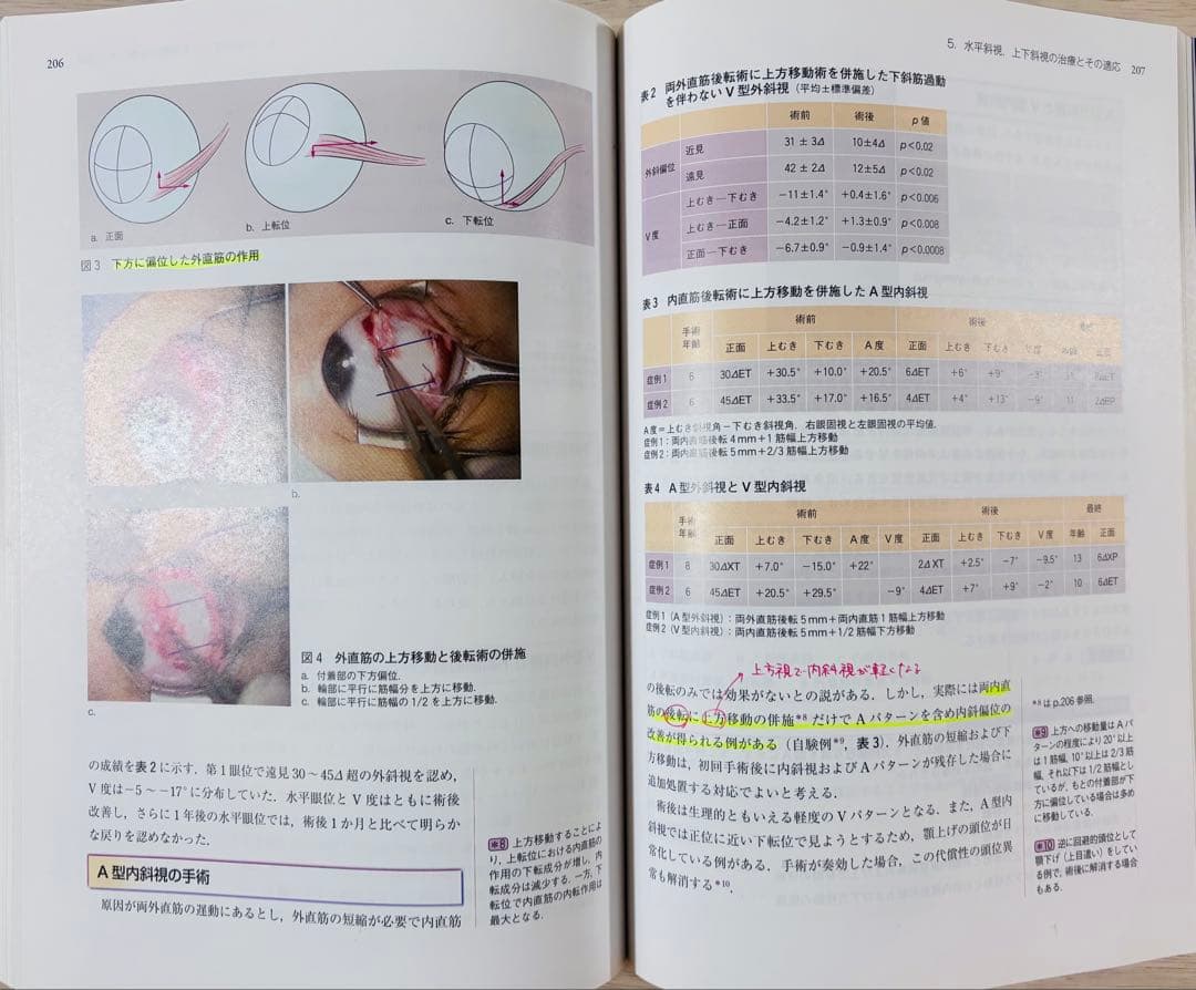 眼科診療クオリファイ 22 弱視・斜視診療のスタンダード（書き込み少々あり）