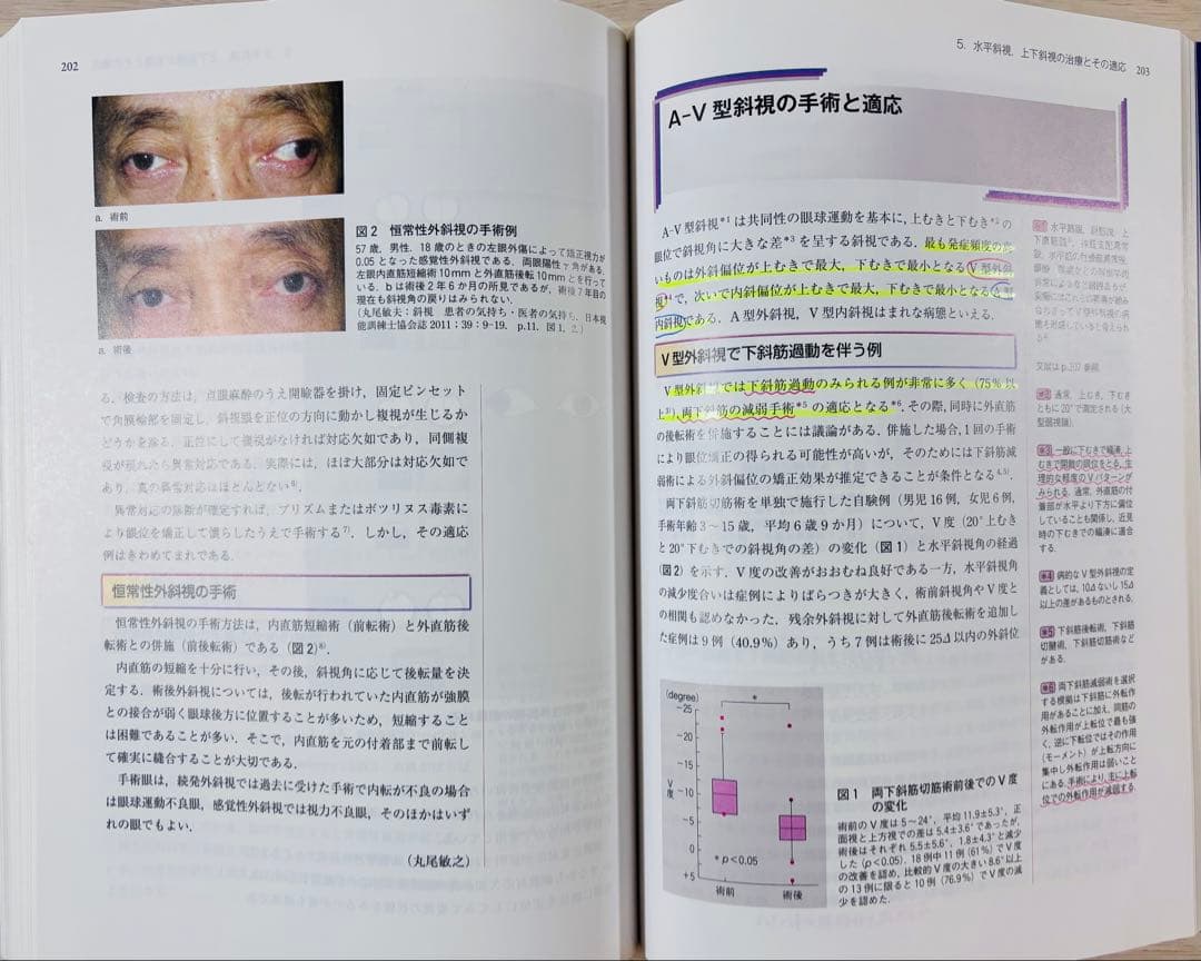 眼科診療クオリファイ 22 弱視・斜視診療のスタンダード（書き込み少々あり）
