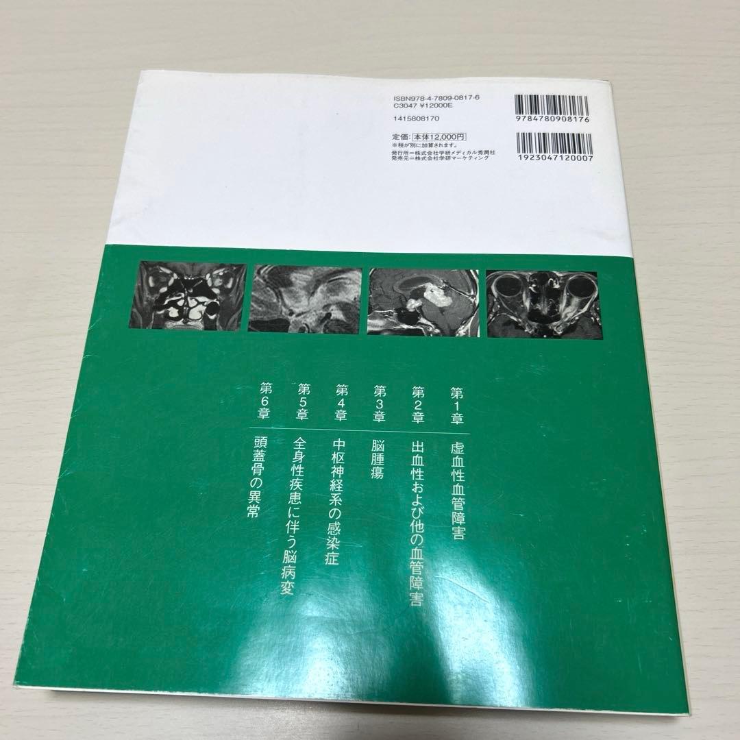 脳MRI 3.血管障害・腫瘍・感染症・他 高橋昭喜 秀潤社