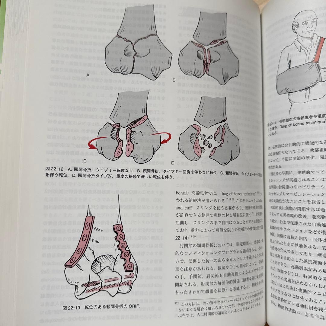 整形系外科的理学療法 第3版