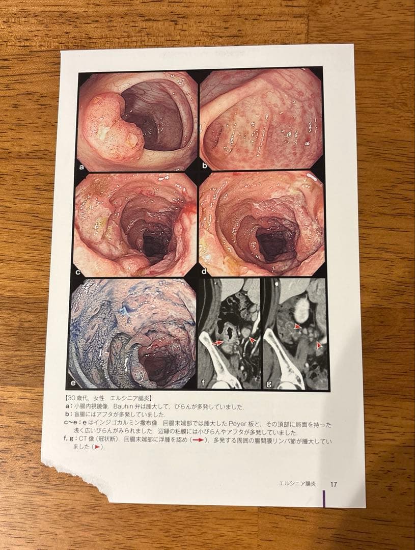消化管内視鏡診断アトラス　上部下部セット