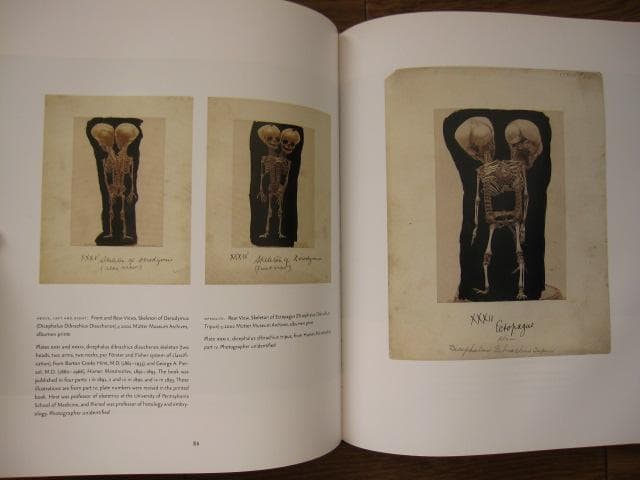 Mutter Museum： Of the College