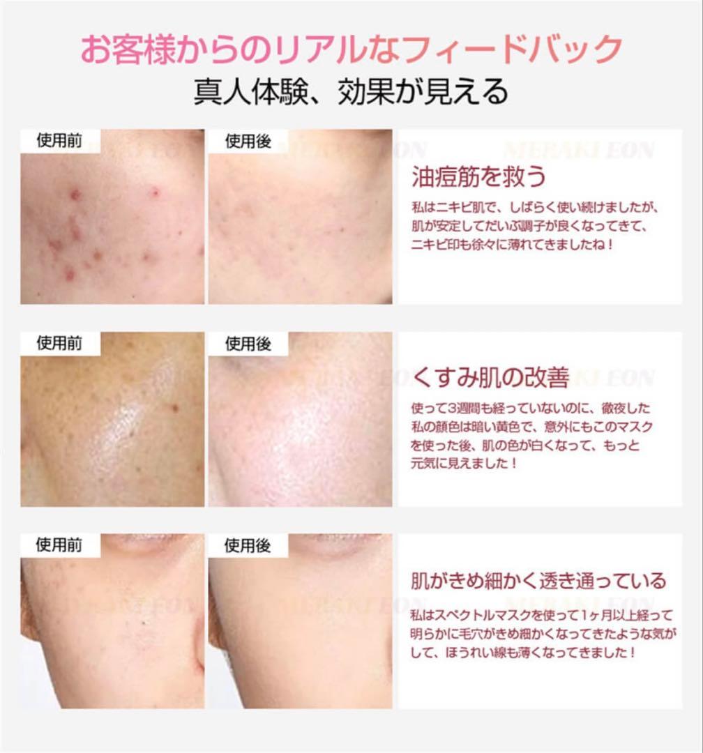 6色LED美顔器 ナノ噴霧機能付き