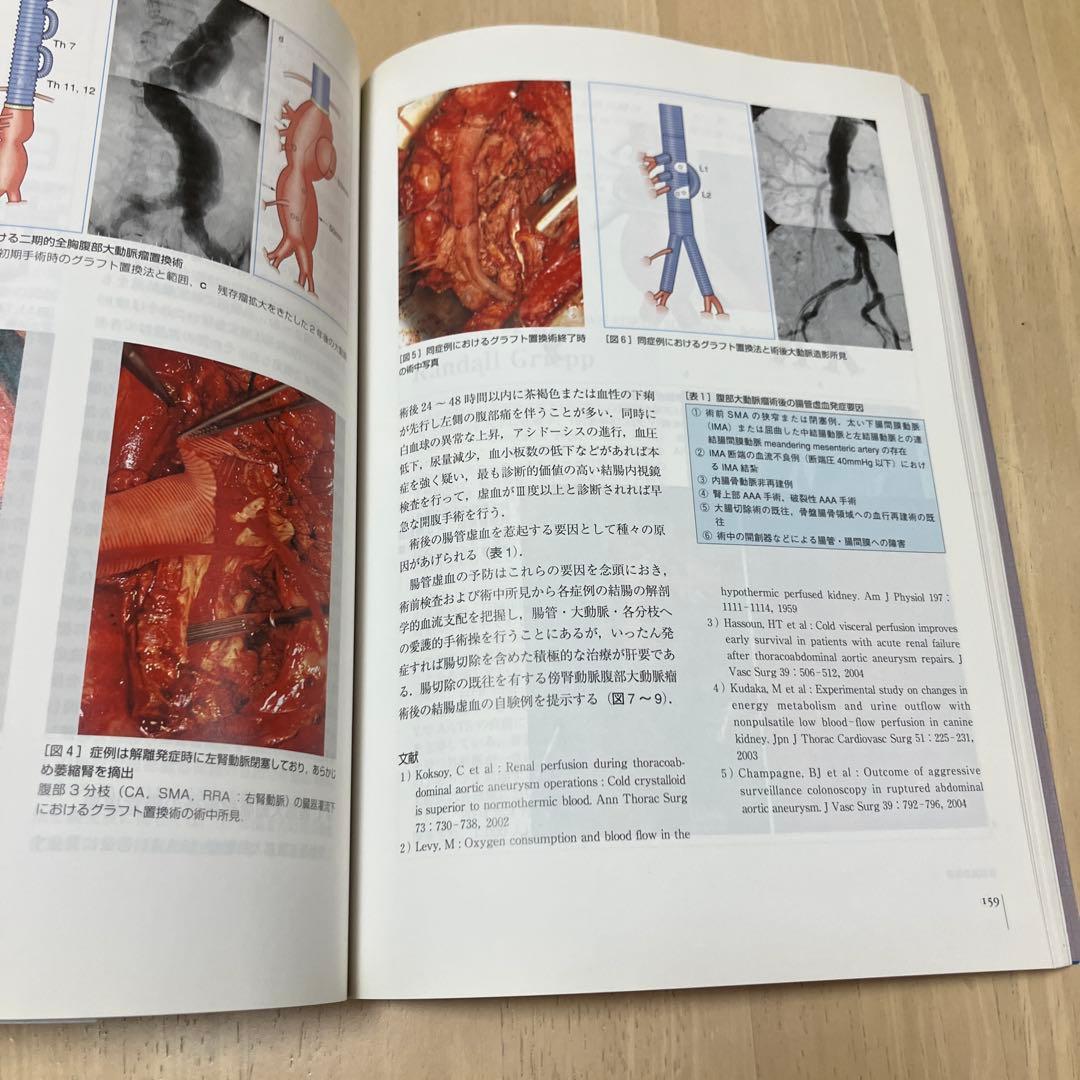 Knack & Pitfalls 大動脈外科の要点と言点
