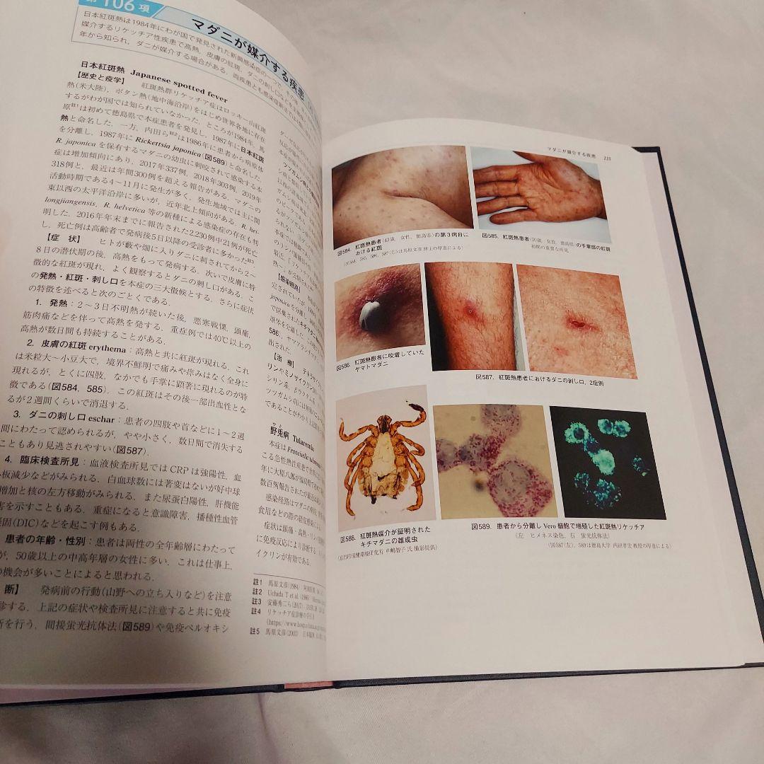 【美品　送料込み】　図説　人体寄生虫学　改訂10版　おすすめの医学書です