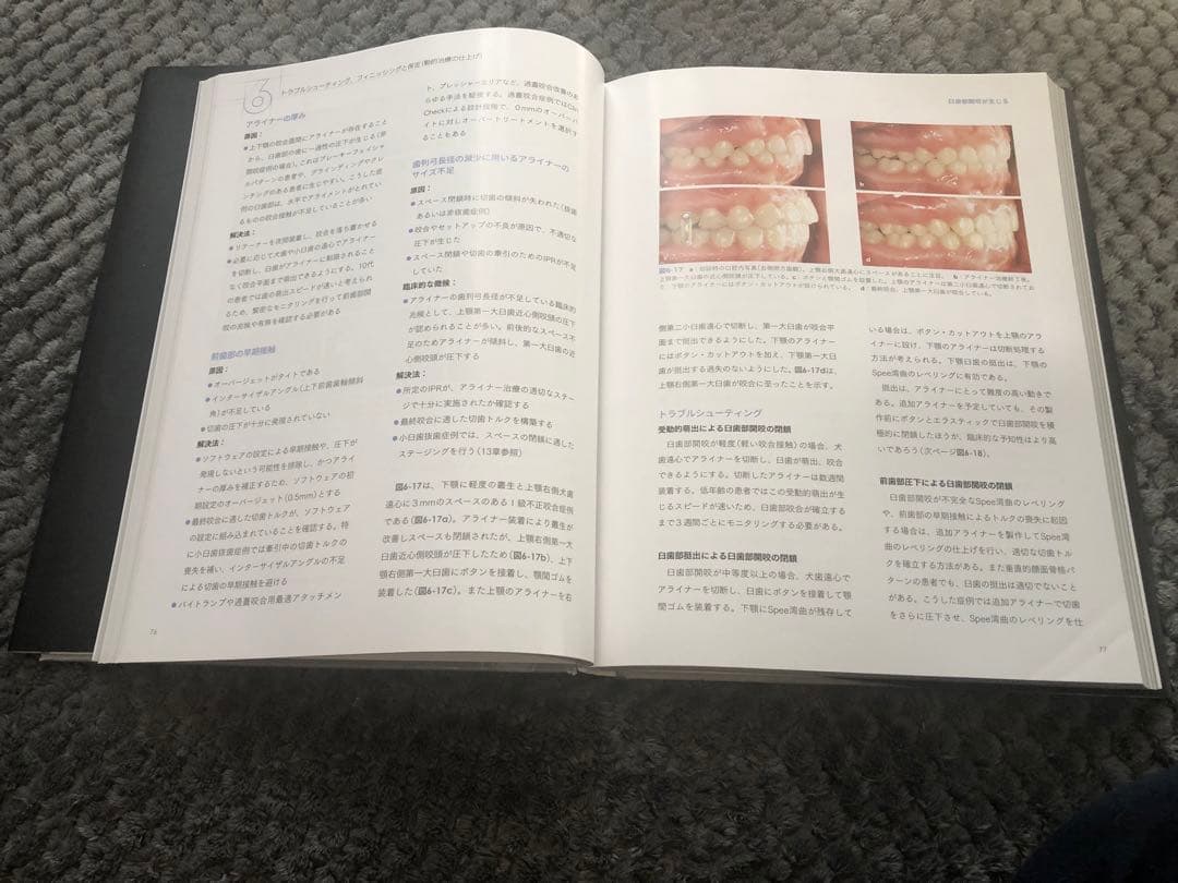 【美品】アライナー矯正歯科治療