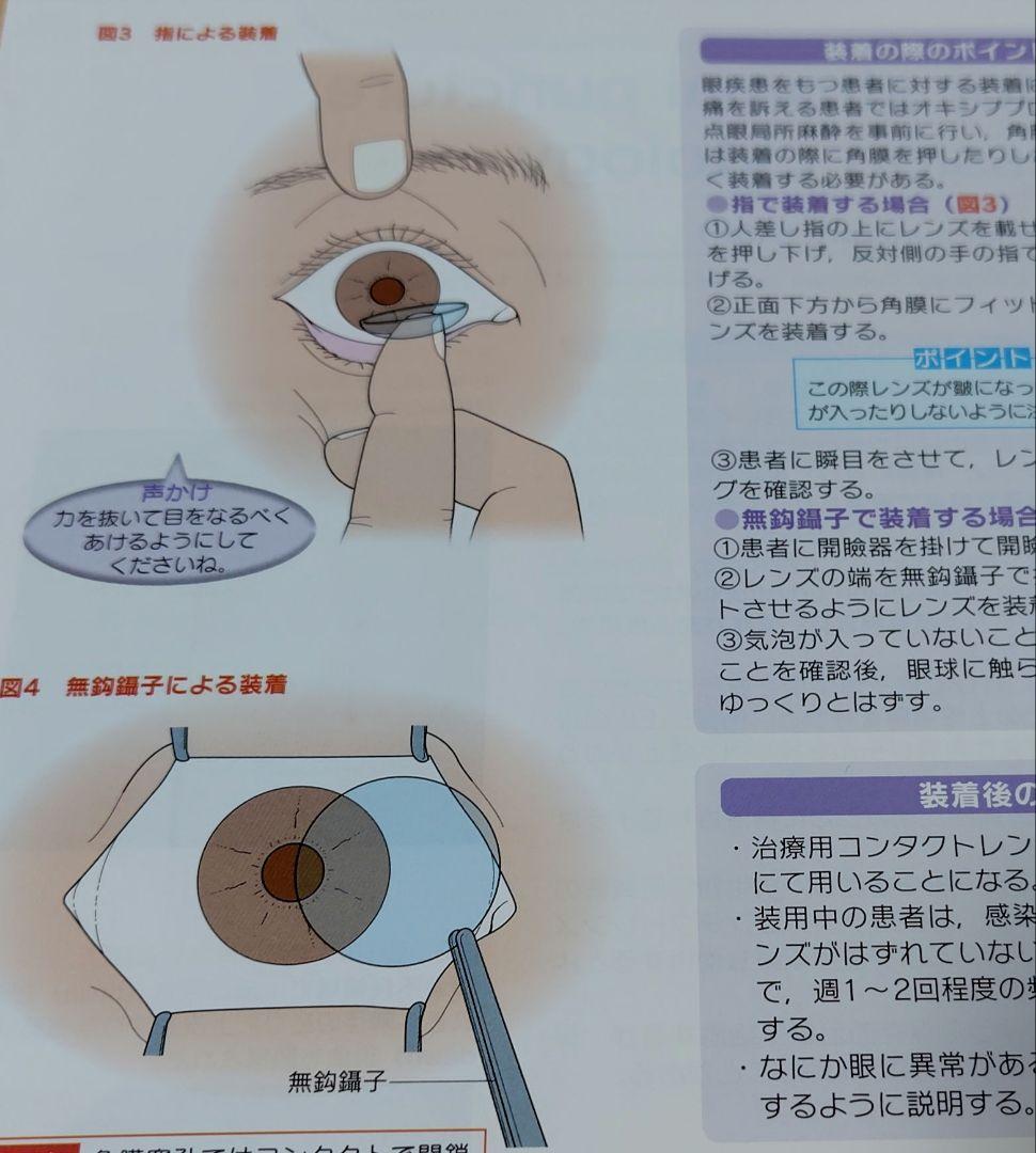 【裁断済】眼科外来処置・小手術 クローズアップ