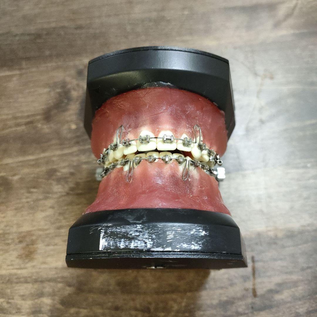 YDM製タイポドント咬合器