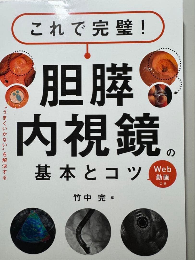 【裁断済み】これで完璧!胆膵内視鏡の基本とコツ