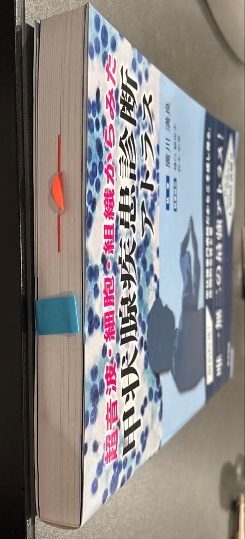 甲状腺疾患診断　アトラス