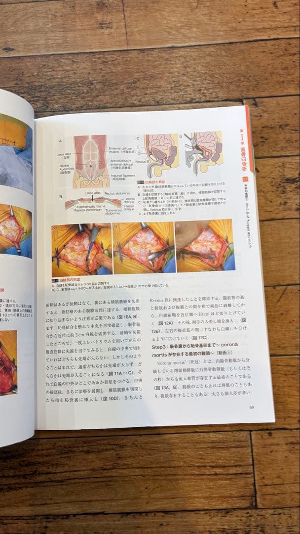 骨盤骨折　寛骨臼骨折・骨盤輪骨折の手術手技　整形外科