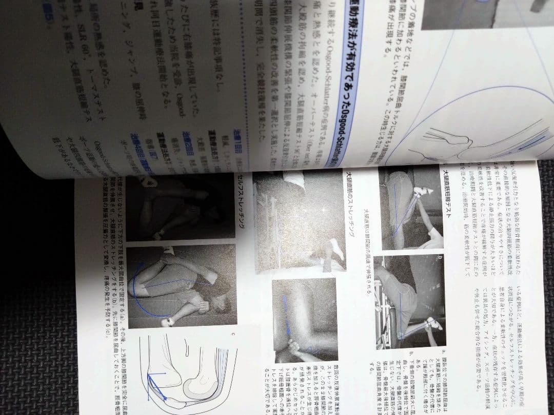 整形外科運動療法ナビゲーション　関節機能解剖学に基づく 下肢体幹　理学療法　PT