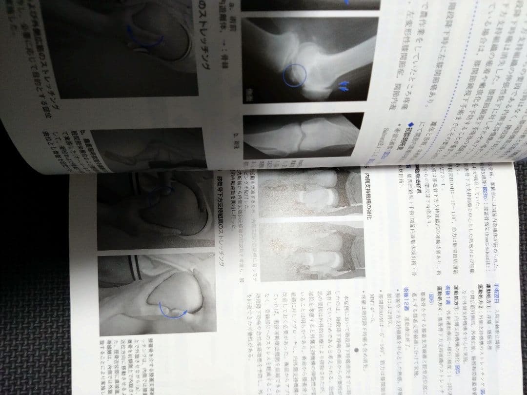 整形外科運動療法ナビゲーション　関節機能解剖学に基づく 下肢体幹　理学療法　PT